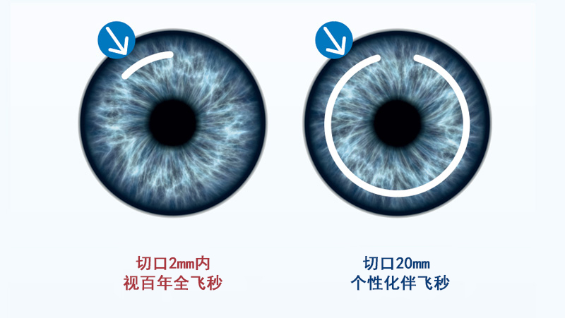 全飞秒和半飞秒